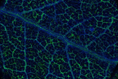 Eucalyptusblaetter enthalten Gold.jpg